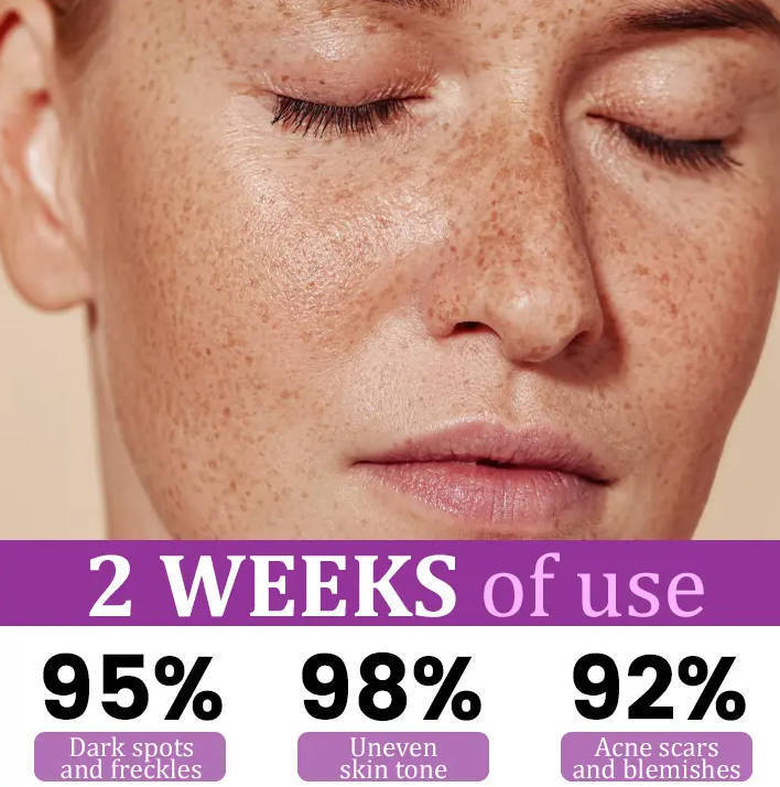 Melantrax Anti Hyperpigmentation Essence