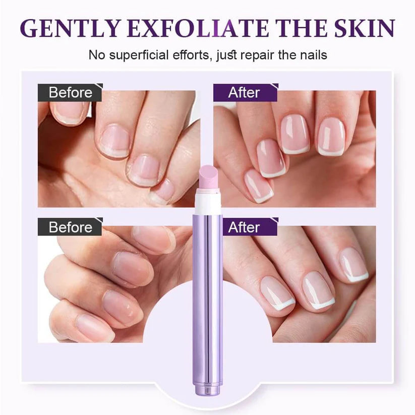 Anti-Hangnail Nail Essence Pen Nutrition Pen Oil