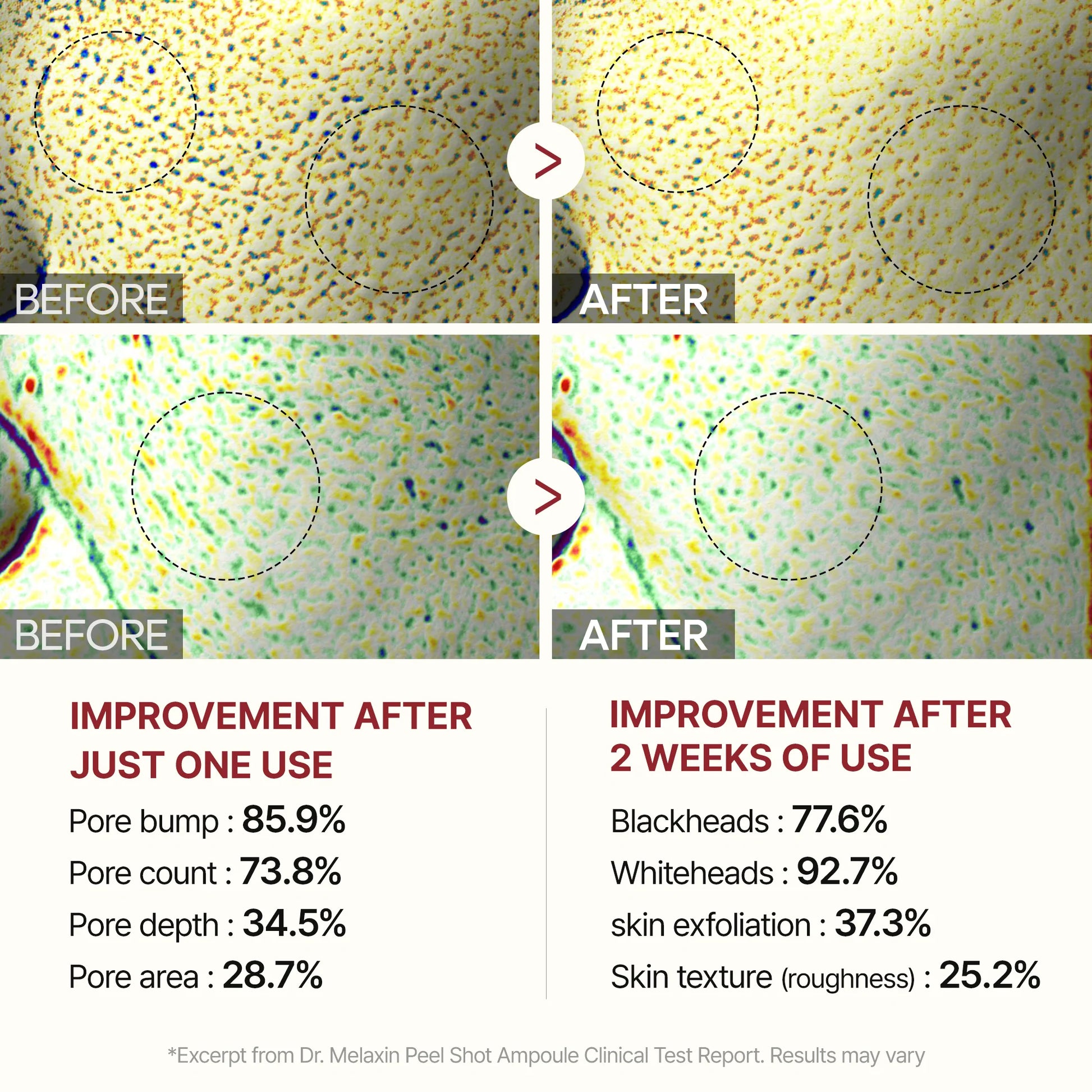 10 Pieces Dr.Melaxin Skin restoration and correction