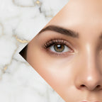 Dr.Melaxin - After Treatment