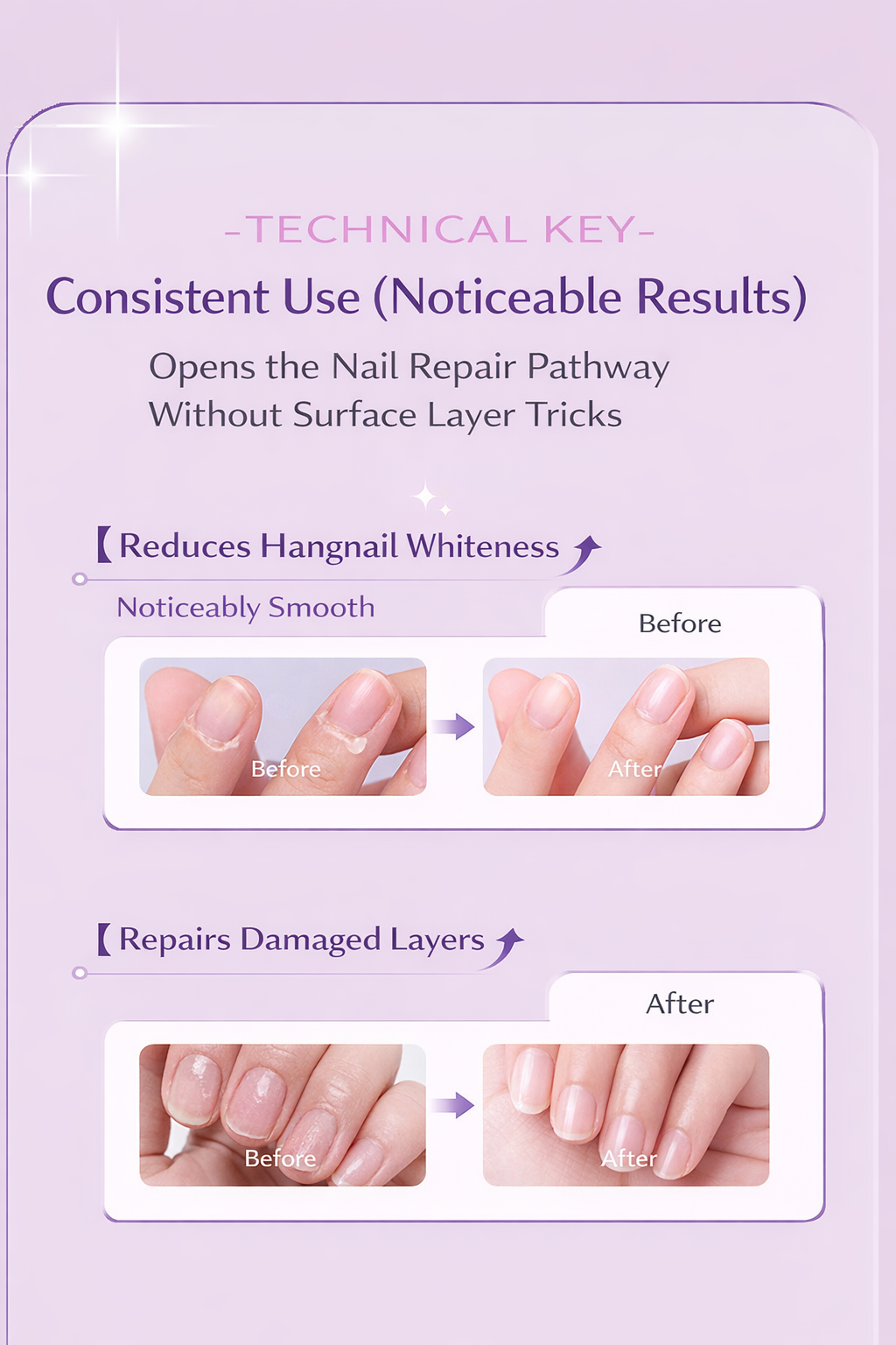 Anti-Hangnail Nail Essence Pen Nutrition Pen Oil